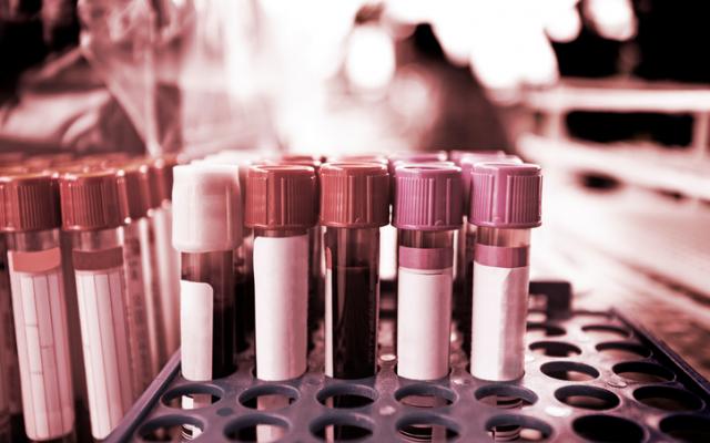 zika test tubes medical research blood