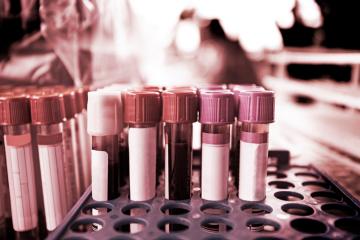 zika test tubes medical research blood