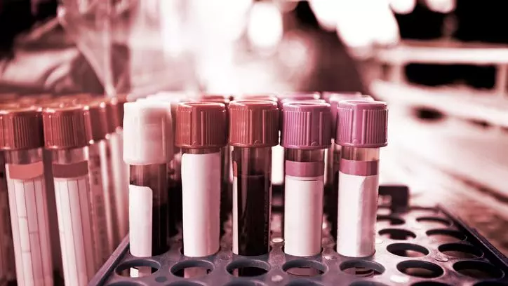 zika test tubes medical research blood