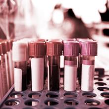 zika test tubes medical research blood